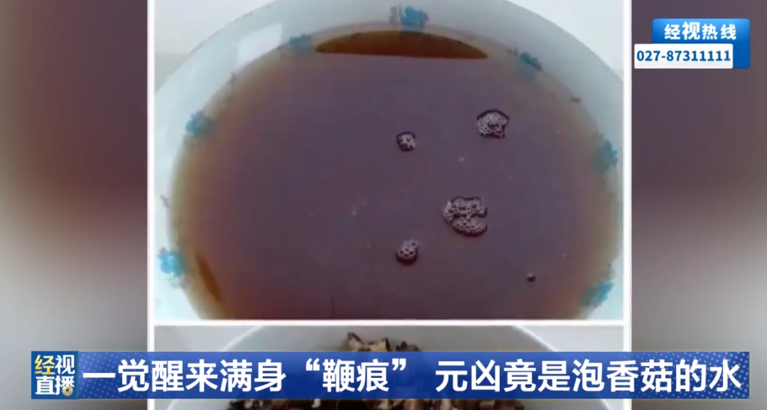 一觉醒来，男子身上遍布“鞭痕”，原因竟是一碗水；这些食物“焯一下”远远不够
