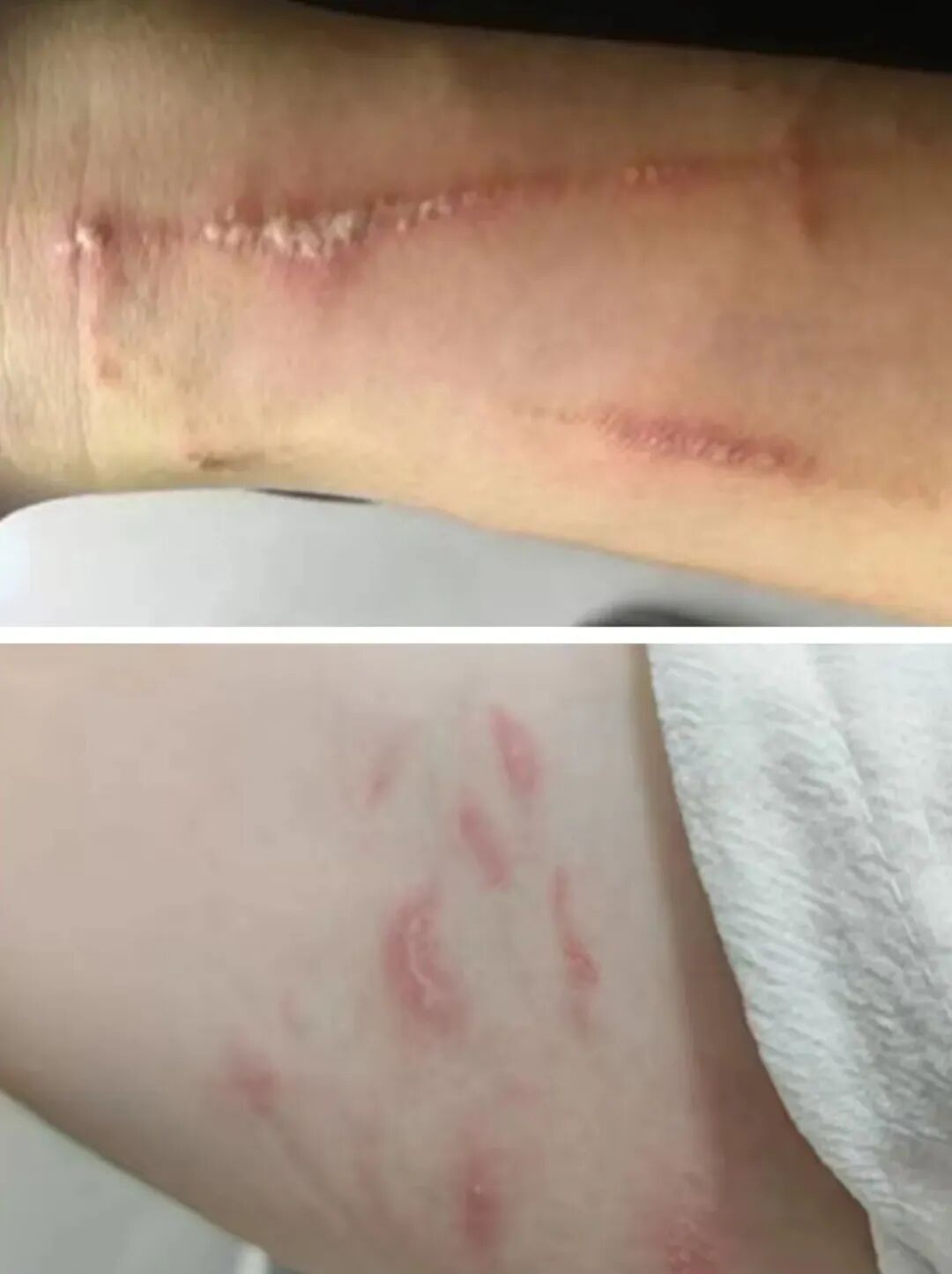 河南近期高发，警惕“飞行的硫酸”！