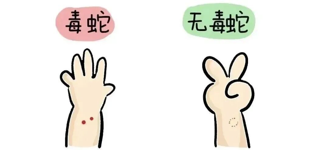88岁老人家门口遇到眼镜蛇，一脚踢过去反被咬！家属打死毒蛇后做对了一件事→