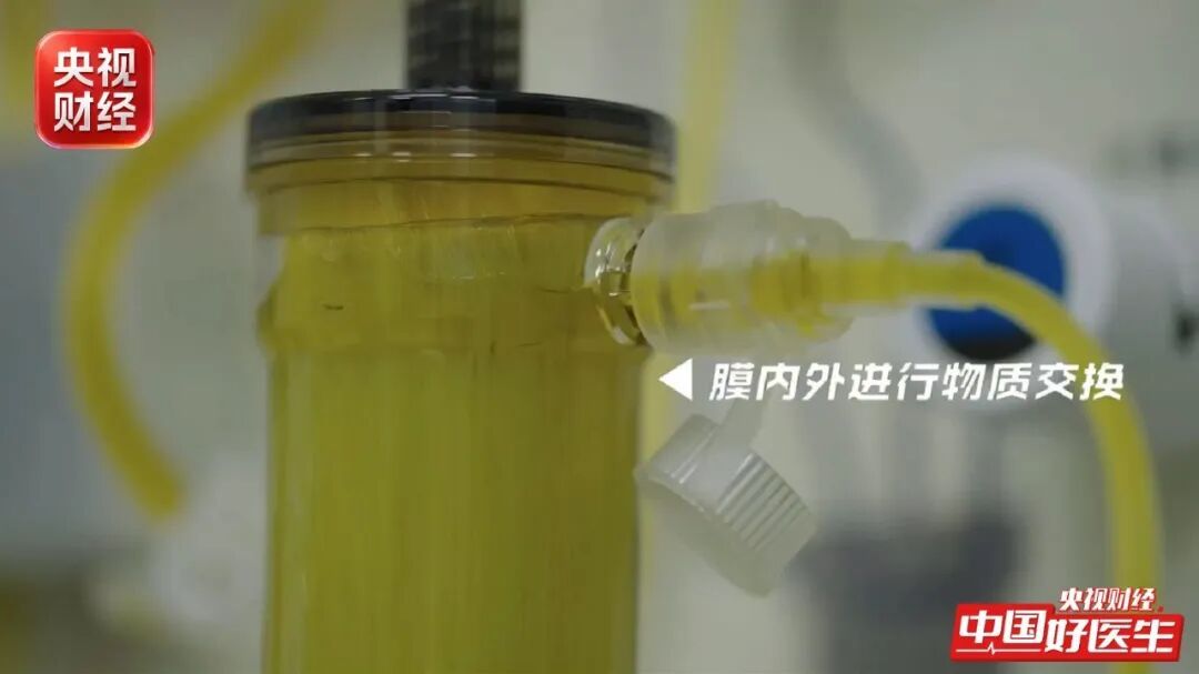 乙肝、脂肪肝、酒精肝…如何一步步拖成肝衰竭？