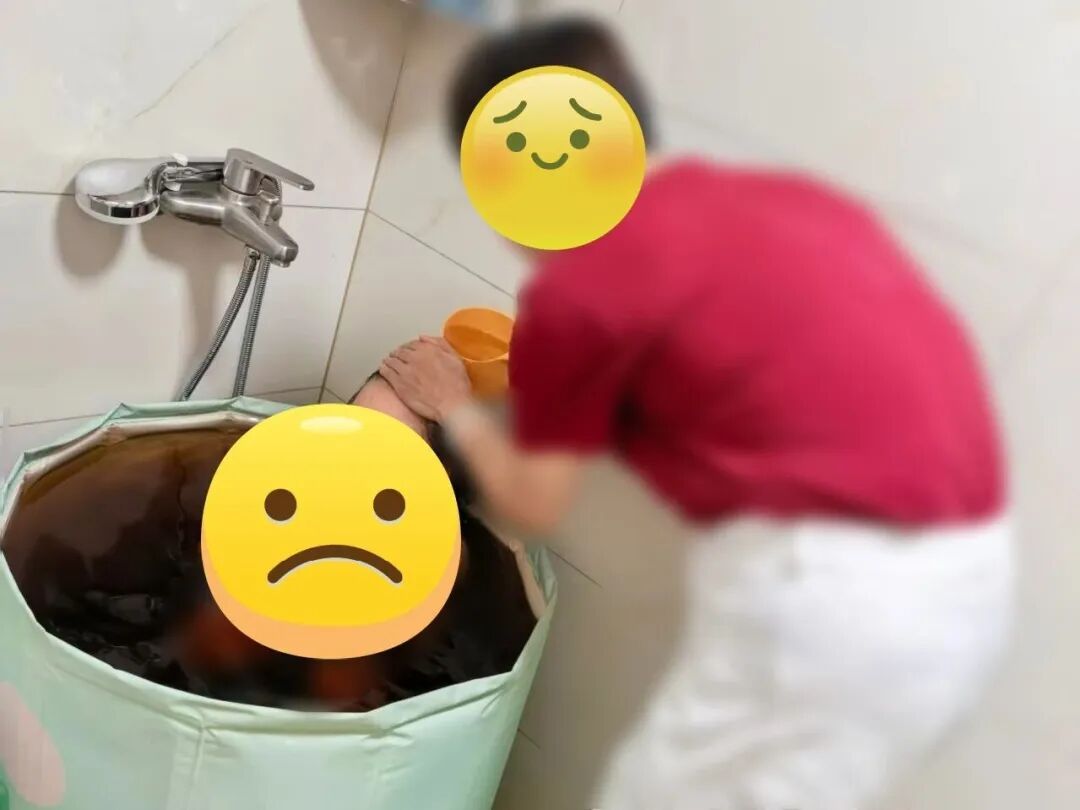 深圳7岁女童,全身80%皮肤糜烂、渗液!竟是因熟人推荐的“止痒秘方”… 深圳7岁女童,全身80%皮肤糜烂、渗液!竟是因熟人推荐的“止痒秘方”…