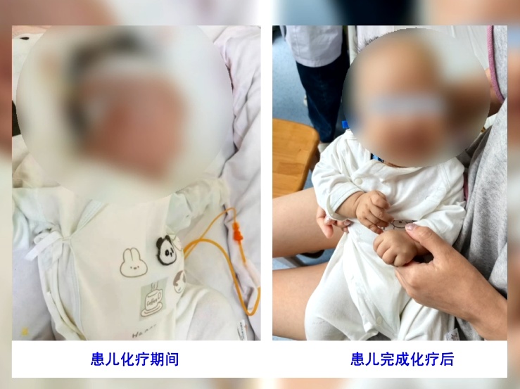 胎儿还没出生就查出肿瘤!贵州医护多学科接力,超低龄宝宝闯关成功顺利出院 胎儿还没出生就查出肿瘤!贵州医护多学科接力,超低龄宝宝闯关成功顺利出院