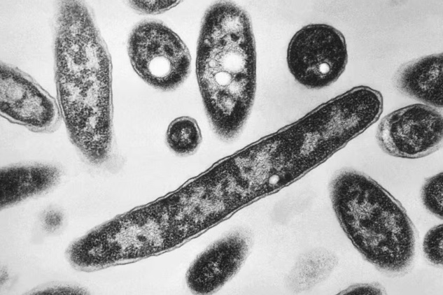 奥地利林茨军团菌疫情扩散 已致3人死亡 奥地利林茨军团菌疫情扩散 已致3人死亡