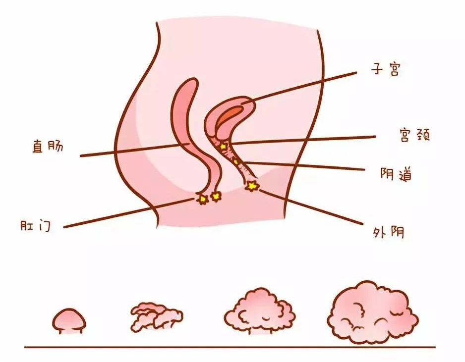 女子用公用瑜伽垫后感染HPV!医生:这些“高危物品”千万别共用 女子用公用瑜伽垫后感染HPV!医生:这些“高危物品”千万别共用