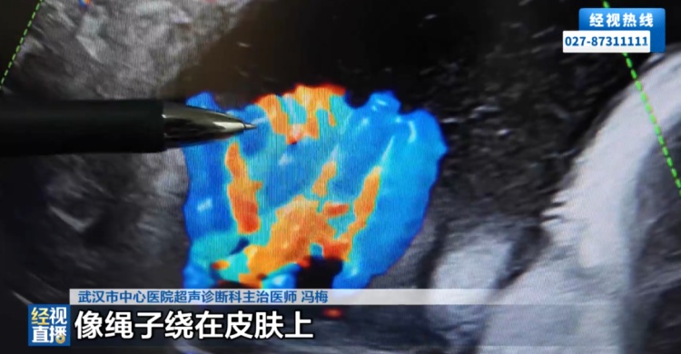 武汉37周孕妈腹中胎儿突发剧烈躁动、胎动幅度极大!医生检查后惊呆 武汉37周孕妈腹中胎儿突发剧烈躁动、胎动幅度极大!医生检查后惊呆