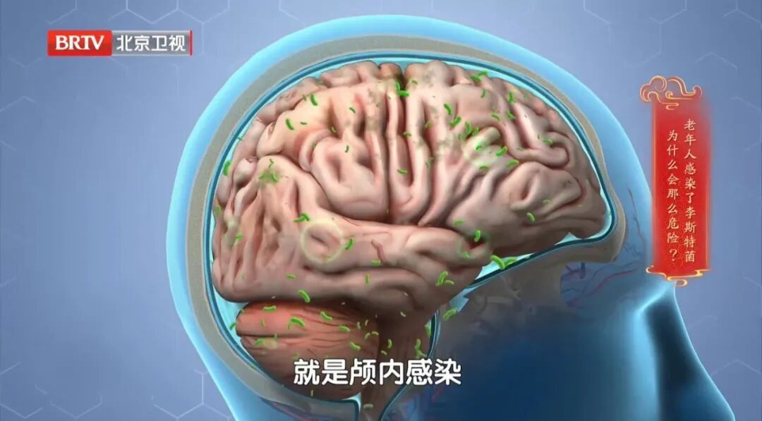 马上检查你家冰箱！78岁奶奶遭感染后命悬一线，元凶几乎家家都有