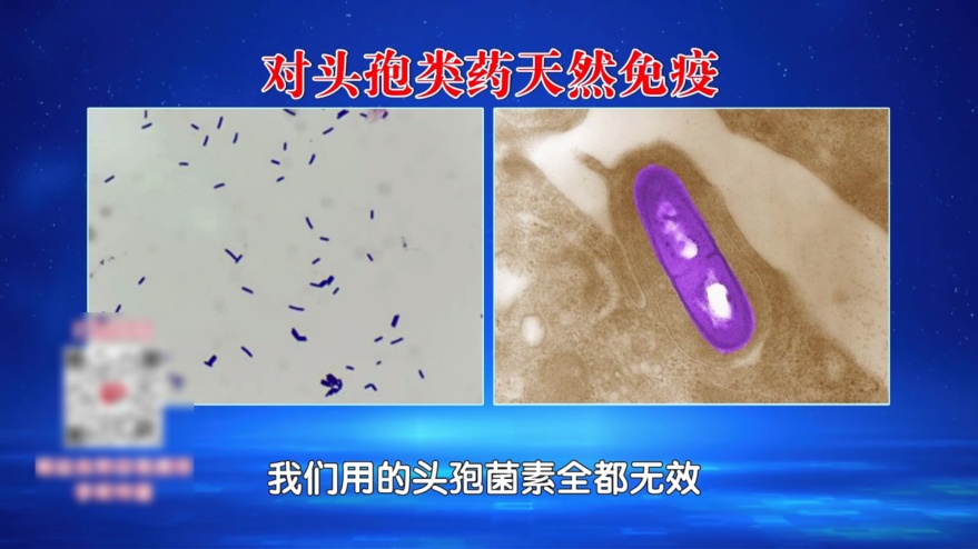 马上检查你家冰箱！78岁奶奶遭感染后命悬一线，元凶几乎家家都有