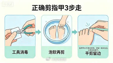指甲剪圆还是剪方?很多人剪指甲都剪错了! 指甲剪圆还是剪方?很多人剪指甲都剪错了!