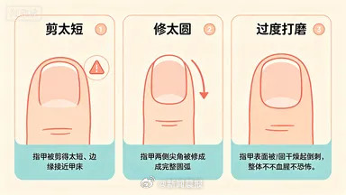 指甲剪圆还是剪方?很多人剪指甲都剪错了! 指甲剪圆还是剪方?很多人剪指甲都剪错了!