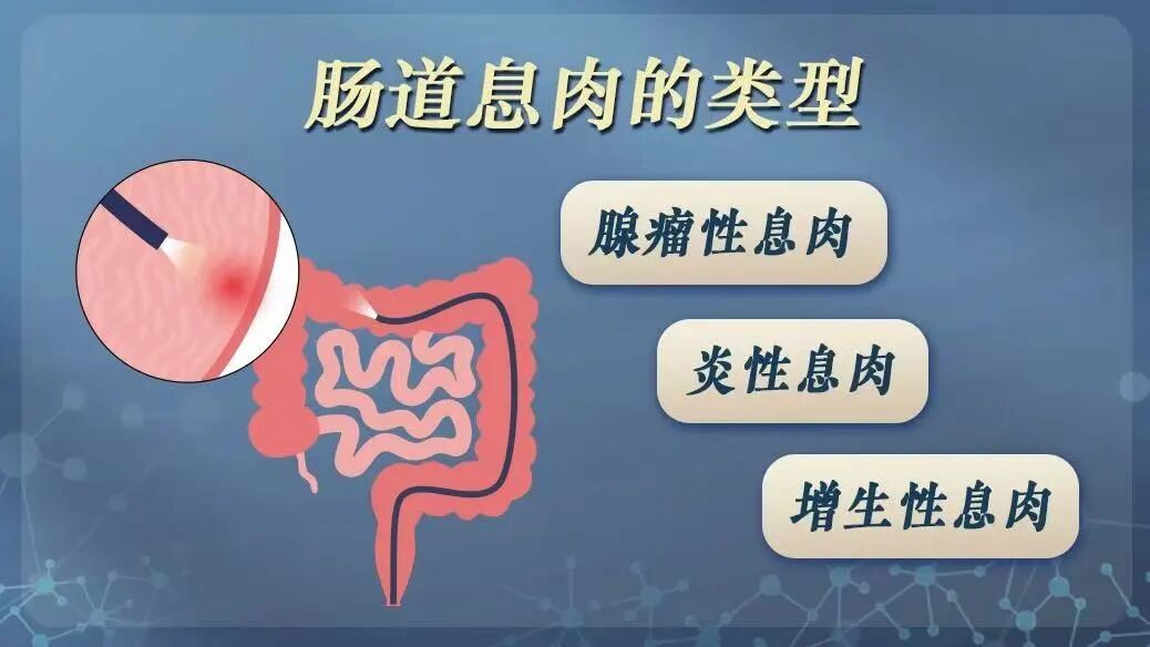 打喷嚏别怪感冒,拉肚子别怪吃错?换季身体预警信号全解读 打喷嚏别怪感冒,拉肚子别怪吃错?换季身体预警信号全解读