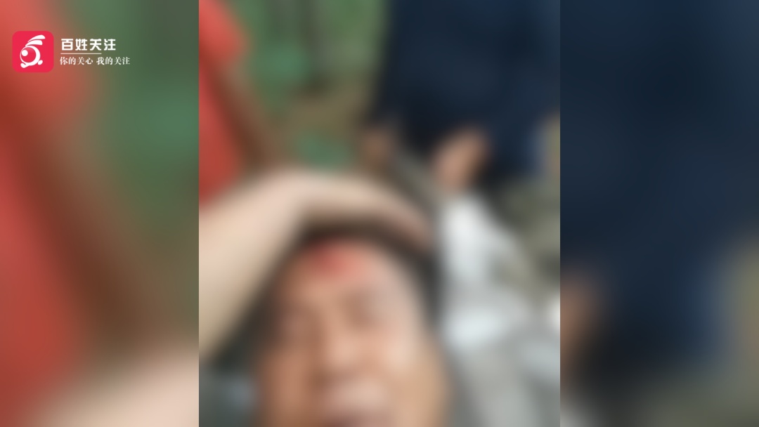 吉林一男子上山采松塔突发意外,从近10米树上坠落致腰椎骨折 吉林一男子上山采松塔突发意外,从近10米树上坠落致腰椎骨折