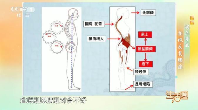 总是腰酸、腰痛?可能是骨盆前倾的信号,一招自测 总是腰酸、腰痛?可能是骨盆前倾的信号,一招自测