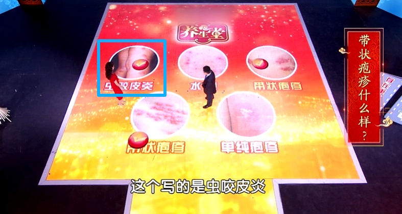 身上经常痒,病根可能在内脏,第1种就是癌,别只当蚊子包、皮肤病 身上经常痒,病根可能在内脏,第1种就是癌,别只当蚊子包、皮肤病