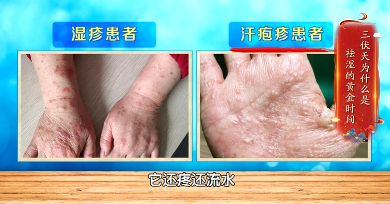 身上经常痒,病根可能在内脏,第1种就是癌,别只当蚊子包、皮肤病 身上经常痒,病根可能在内脏,第1种就是癌,别只当蚊子包、皮肤病