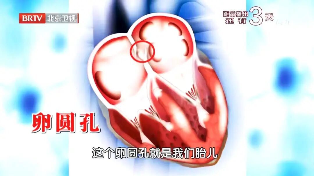洗完头竟突发中风?这个致命动作,很多人可能天天在做,赶紧改 洗完头竟突发中风?这个致命动作,很多人可能天天在做,赶紧改