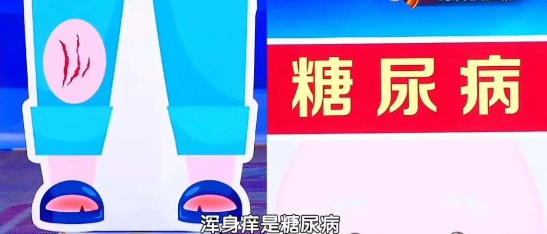身上经常痒,病根可能在内脏,第1种就是癌,别只当蚊子包、皮肤病 身上经常痒,病根可能在内脏,第1种就是癌,别只当蚊子包、皮肤病