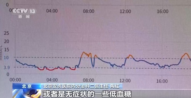 健康人群佩戴动态血糖仪陷入“数字焦虑” 专家提示→ 健康人群佩戴动态血糖仪陷入“数字焦虑” 专家提示→