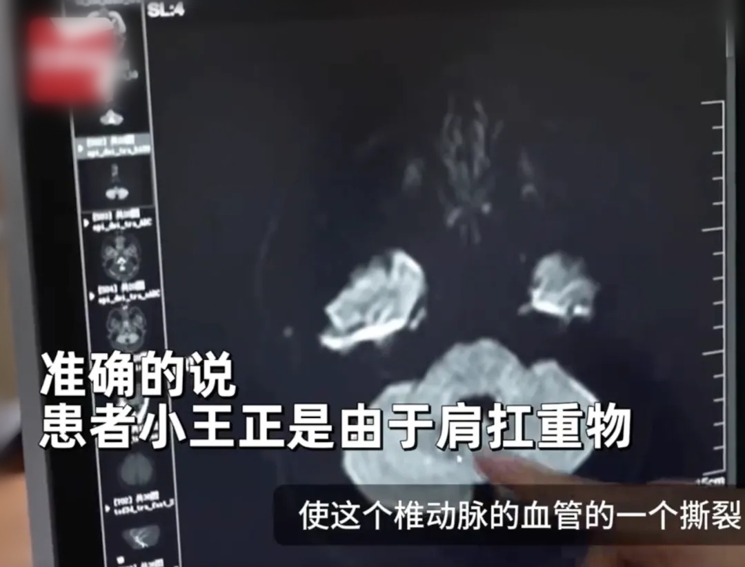 洗完头竟突发中风?这个致命动作,很多人可能天天在做,赶紧改 洗完头竟突发中风?这个致命动作,很多人可能天天在做,赶紧改