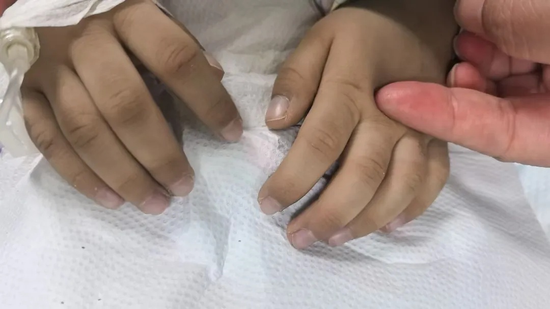 3岁男孩长期吃隔夜饭菜，中毒进PICU