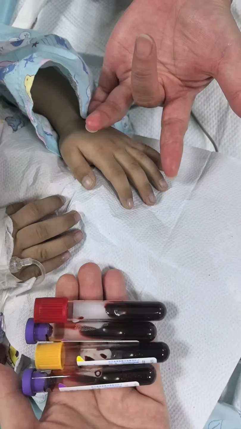 3岁男孩长期吃隔夜饭菜，中毒进PICU