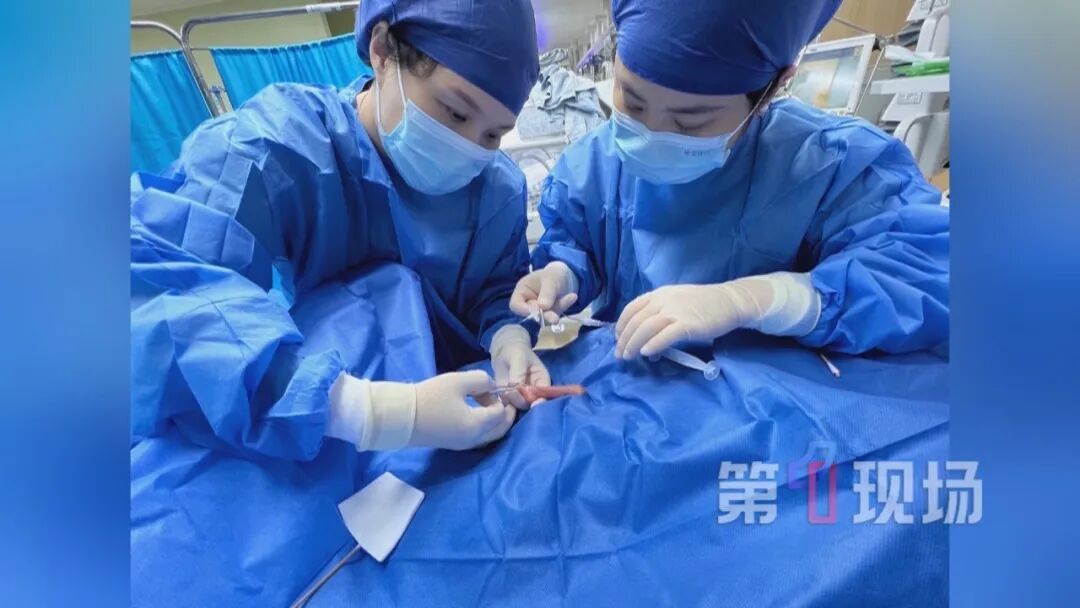 深圳一婴儿早产116天,仅330克,脚掌比成人拇指还小!105天完成生命“闯关” 深圳一婴儿早产116天,仅330克,脚掌比成人拇指还小!105天完成生命“闯关”