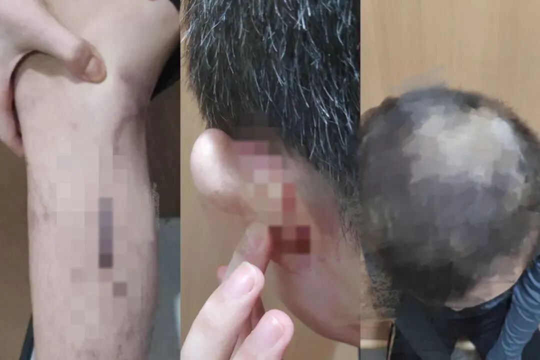 “高薪”变“高危”!揭秘“境外高薪”背后的血泪陷阱 “高薪”变“高危”!揭秘“境外高薪”背后的血泪陷阱