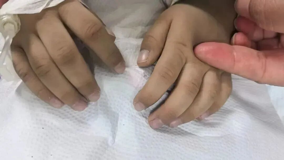 3岁男孩中毒进PICU!这种饮食习惯,家长赶快自查→ 3岁男孩中毒进PICU!这种饮食习惯,家长赶快自查→