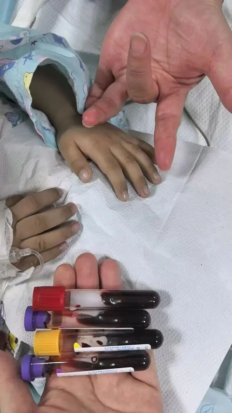 长期吃隔夜饭菜,3岁男孩中毒进PICU 长期吃隔夜饭菜,3岁男孩中毒进PICU