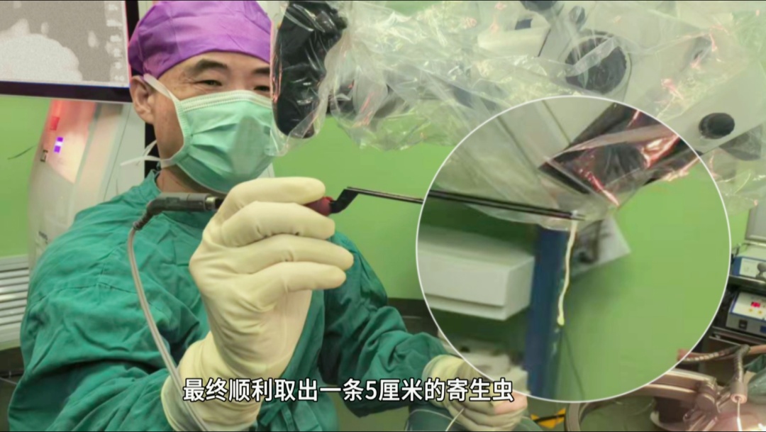 56岁女子脸歪无力9年，不是中风不是肿瘤！真凶竟是脑子里的一条活虫