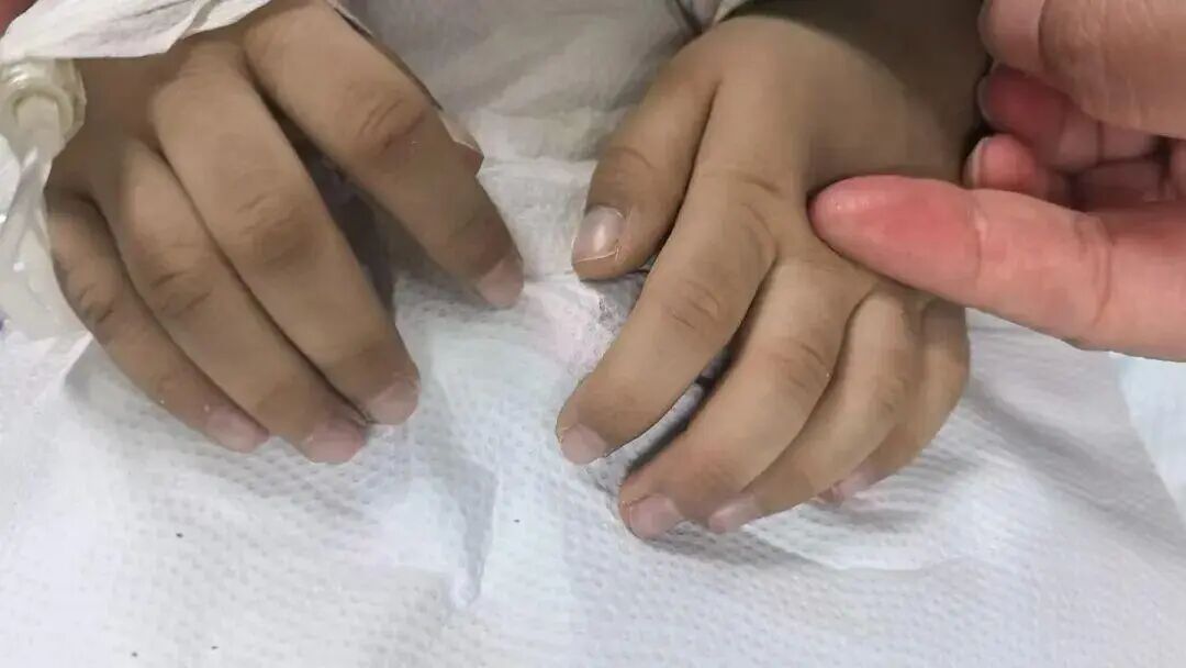 长期吃隔夜饭菜,3岁男孩中毒进PICU 长期吃隔夜饭菜,3岁男孩中毒进PICU