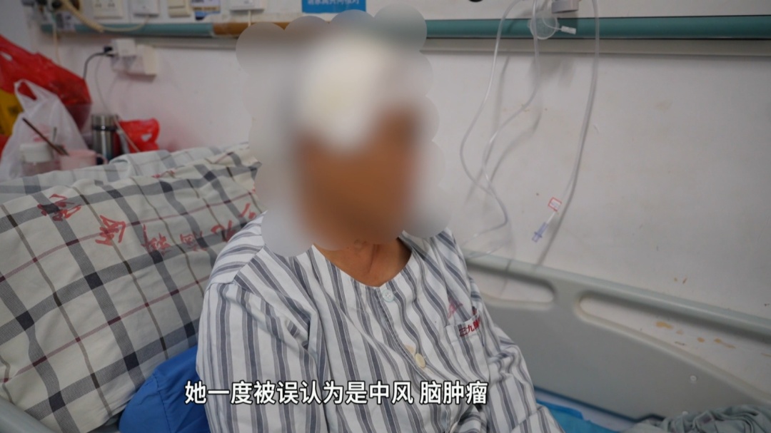 56岁女子脸歪无力9年，不是中风不是肿瘤！真凶竟是脑子里的一条活虫