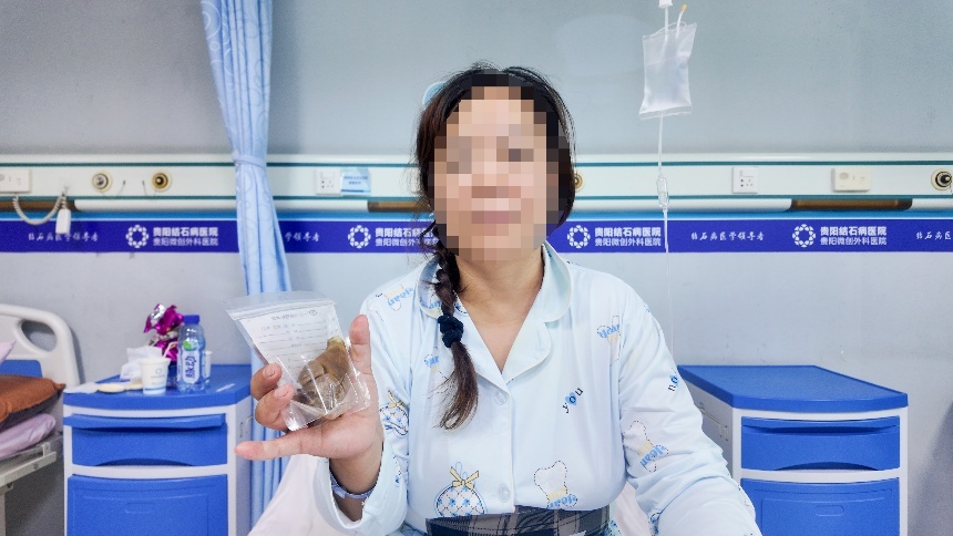 罕见!9公分超大结石险些“撑爆”胆囊!专家:这些生活习惯要避免…… 罕见!9公分超大结石险些“撑爆”胆囊!专家:这些生活习惯要避免……