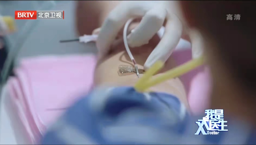 这种恶性肿瘤,一开始像得了感冒,很多人发现的时候,错过了“救命时间”… 这种恶性肿瘤,一开始像得了感冒,很多人发现的时候,错过了“救命时间”…