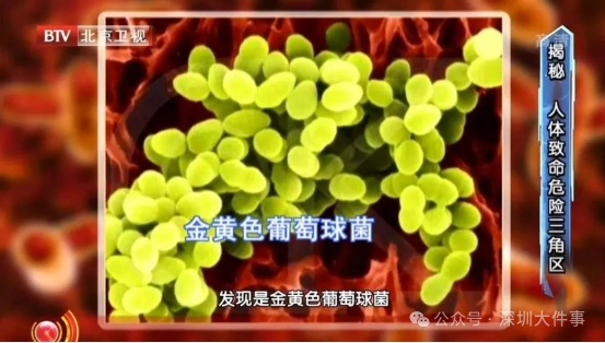尽快扔掉!“甲醛超标”冲上热搜,很多深圳人爱囤家里,比你想象得脏多了!网友炸锅 尽快扔掉!“甲醛超标”冲上热搜,很多深圳人爱囤家里,比你想象得脏多了!网友炸锅
