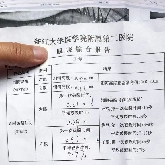 杭州很多人中招,畏光怕风太难受!网友:医生说治不好怎么办? 杭州很多人中招,畏光怕风太难受!网友:医生说治不好怎么办?