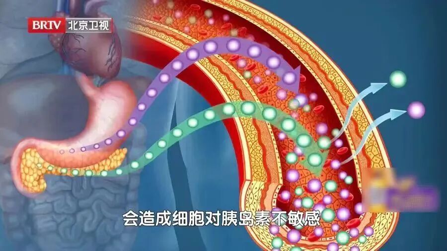 一个被严重低估的控糖小动作,30秒就起效!比走路更省力,腿脚都有劲了 一个被严重低估的控糖小动作,30秒就起效!比走路更省力,腿脚都有劲了