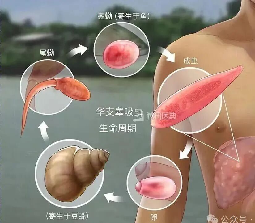 广东人尤其爱吃!高烧10天,深圳女子查出肝功能异常,此前有5人聚餐后全部确诊 广东人尤其爱吃!高烧10天,深圳女子查出肝功能异常,此前有5人聚餐后全部确诊