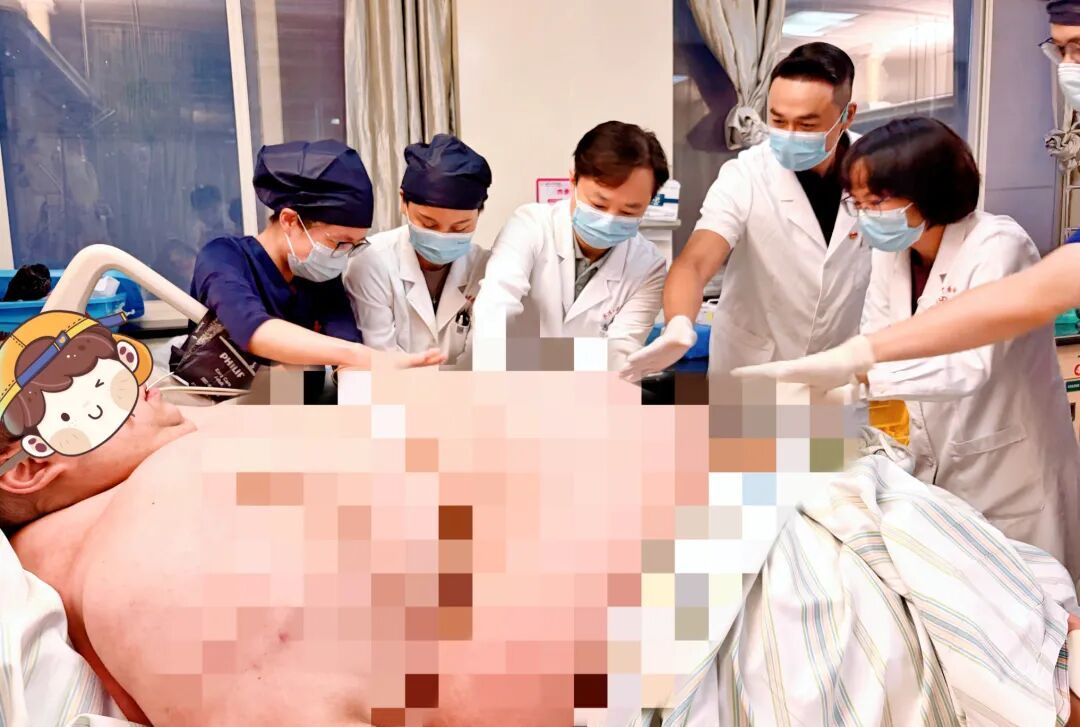 “再胖下去人就没了!”体重635斤男子进ICU,12位医护人员抬上病床 “再胖下去人就没了!”体重635斤男子进ICU,12位医护人员抬上病床