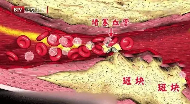 长期炎症会唤醒“癌细胞”!苹果加上它,秒变“天然消炎剂”,快喝起来~ 长期炎症会唤醒“癌细胞”!苹果加上它,秒变“天然消炎剂”,快喝起来~