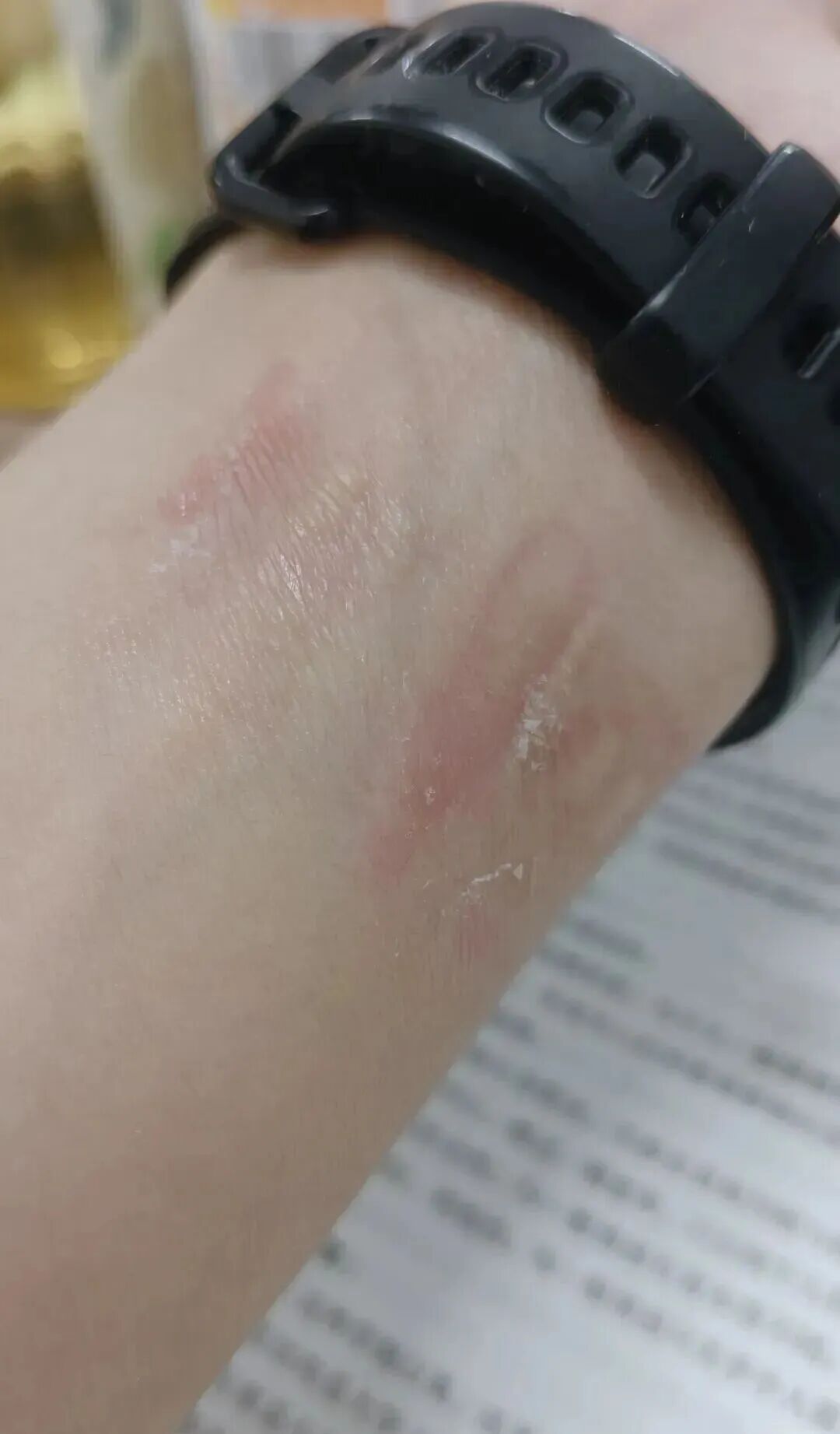 第一批戴运动手环的“受害者”出现了