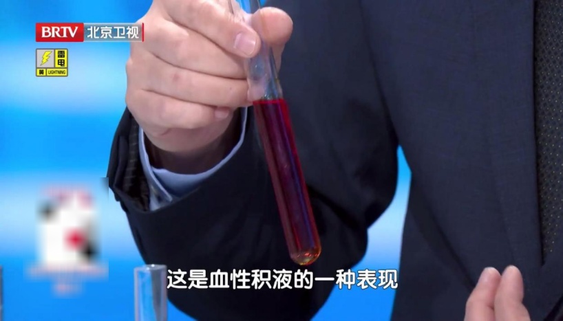 练好这块肌肉,让膝盖多用几年,每天抬抬腿,膝盖不酸胀,走路更稳当 练好这块肌肉,让膝盖多用几年,每天抬抬腿,膝盖不酸胀,走路更稳当