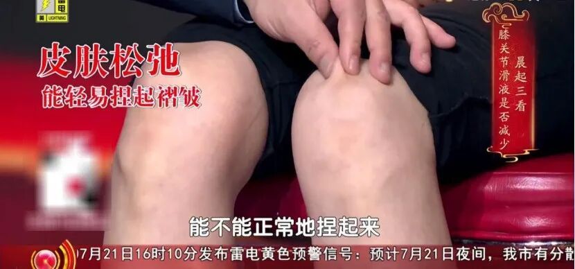 练好这块肌肉,让膝盖多用几年,每天抬抬腿,膝盖不酸胀,走路更稳当 练好这块肌肉,让膝盖多用几年,每天抬抬腿,膝盖不酸胀,走路更稳当