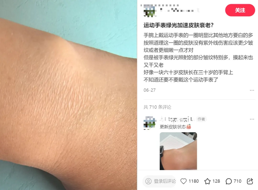 第一批戴运动手环的“受害者”出现了 第一批戴运动手环的“受害者”出现了