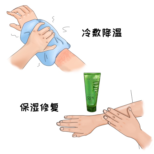 医点通丨长时间户外训练,小心“日晒伤”! 医点通丨长时间户外训练,小心“日晒伤”!