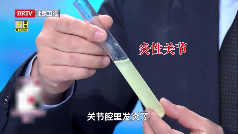 练好这块肌肉,让膝盖多用几年,每天抬抬腿,膝盖不酸胀,走路更稳当 练好这块肌肉,让膝盖多用几年,每天抬抬腿,膝盖不酸胀,走路更稳当