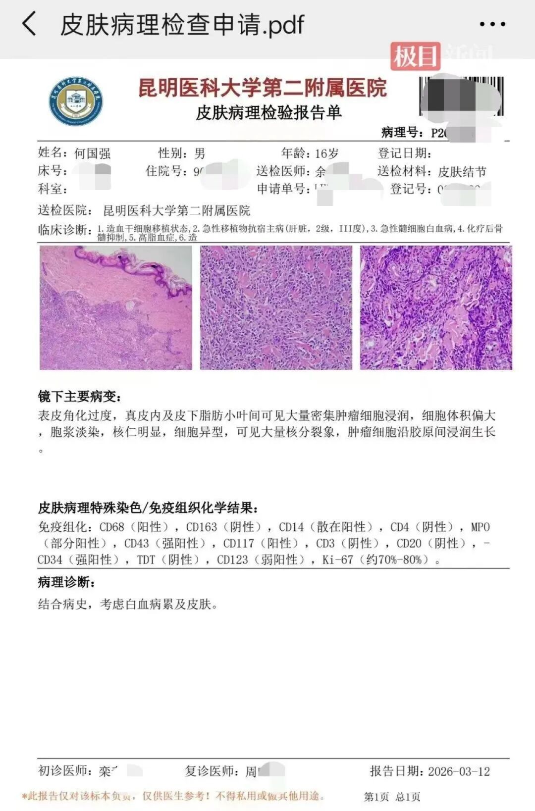 年仅16岁!云南抗癌博主何国强不幸离世 年仅16岁!云南抗癌博主何国强不幸离世