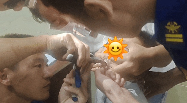 6岁娃玩耍时突然捂嘴,家长掰开一看,发现牙缝里竟卡进了“龙虾钳” 6岁娃玩耍时突然捂嘴,家长掰开一看,发现牙缝里竟卡进了“龙虾钳”