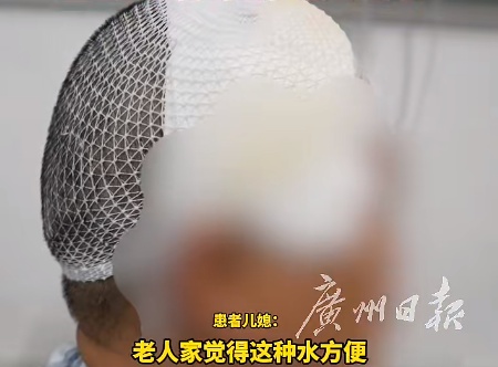女子大量喝这种水,颅内藏活虫7年!"觉得自己没救了" 女子大量喝这种水,颅内藏活虫7年!"觉得自己没救了"