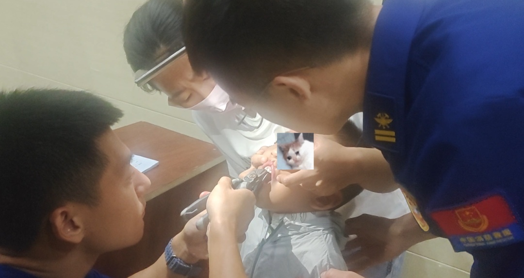 6岁娃玩耍时突然捂嘴,家长掰开一看,发现牙缝里竟卡进了“龙虾钳” 6岁娃玩耍时突然捂嘴,家长掰开一看,发现牙缝里竟卡进了“龙虾钳”