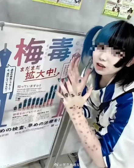 日本暴发梅毒疫情